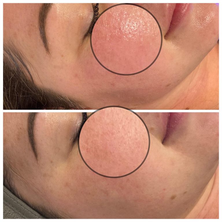 400897106_17992720349369725_2409547125415977469_n