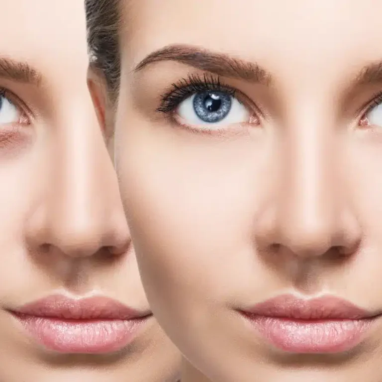 Dark-Circles-Before-After-Stock-Photo