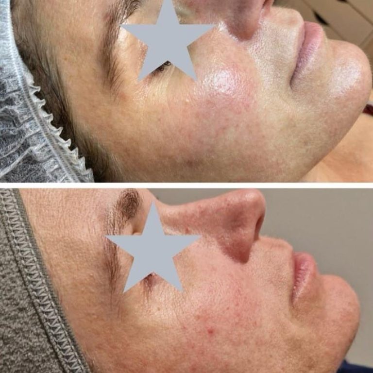 Screenshot 2024-03-07 120517