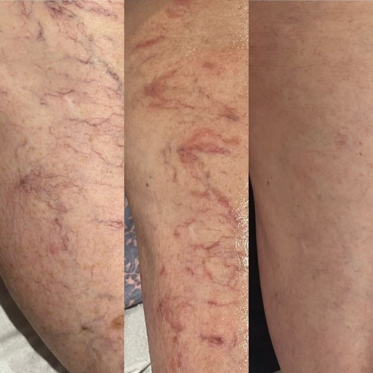 d82e36b3-945f-4ff9-ab60-13ceac1496f5_720