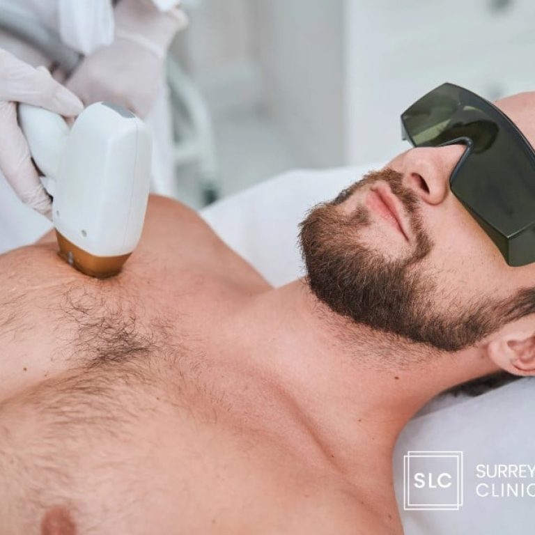 laser_hair_removal_men
