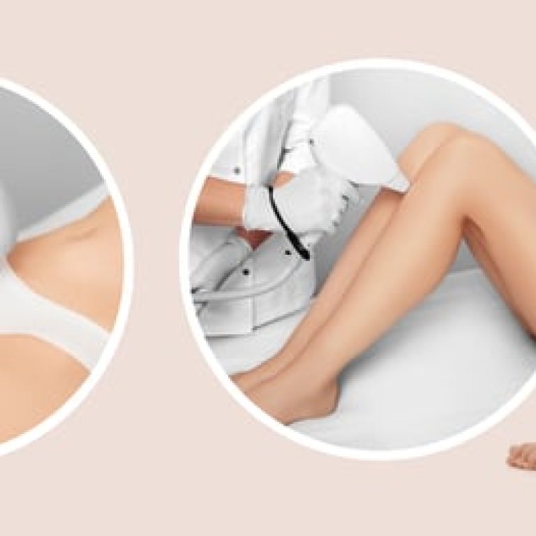 Hair,Remove,Using,Medical,Laser,,Procedure,Body,Epilation.,Technology,Laser